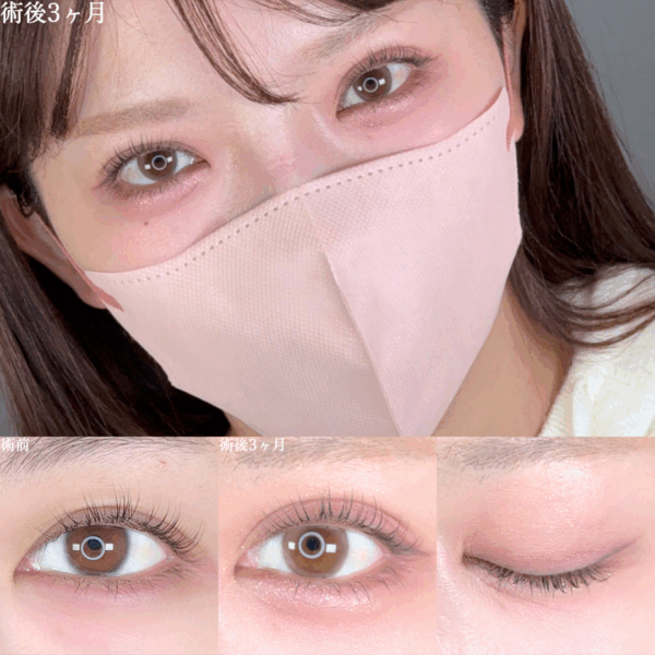 No.8675の症例写真